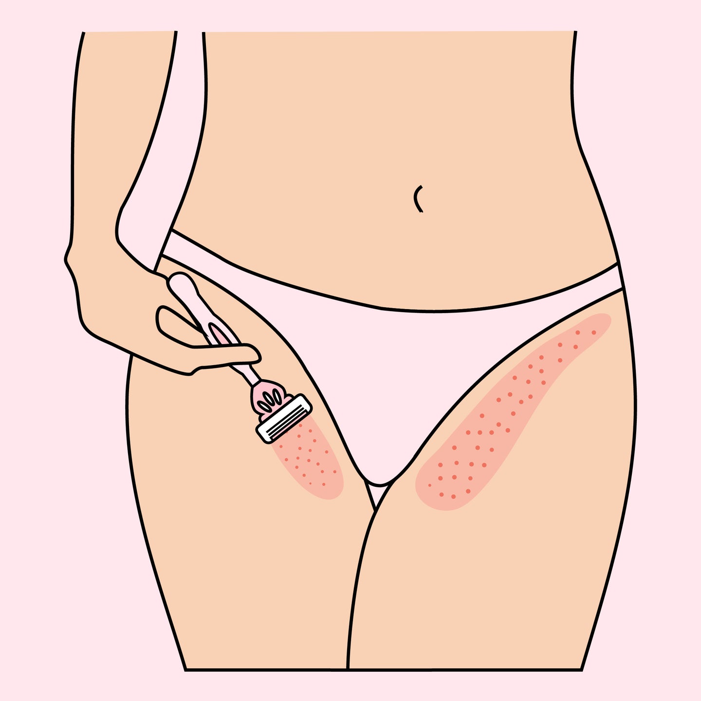 illustration of woman shaving pubic area and trying to prevent razor burn