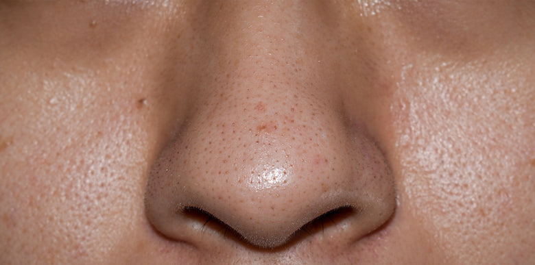 How to Unclog Nose Pores (And Keep Them Clear) – RoseSkinCo.