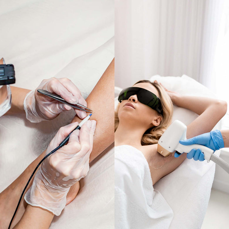 Electrolysis vs Laser Hair Removal