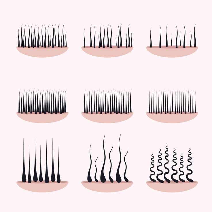 Illustration depicting the different types of pubic hair: wavy, straight, and curly