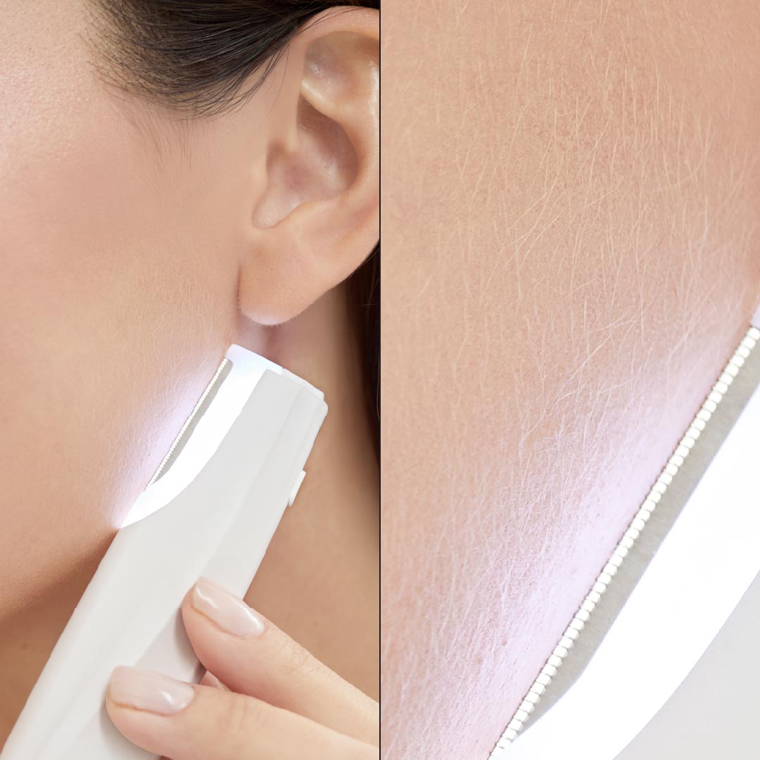 Nura - Sonic Dermaplaner - The Best At Home Dermaplaning Tool